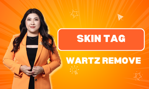 SKIN TAG - WARTZ REMOVE W LED