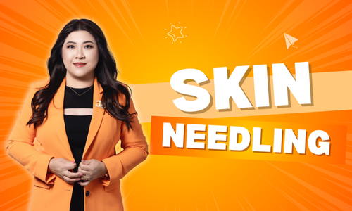 Skin Needling