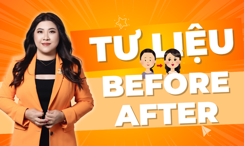 Tư liệu Before - After