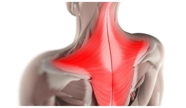 CƠ THANG VÀ BỆNH LÝ ĐAU CỔ VAI GÁY