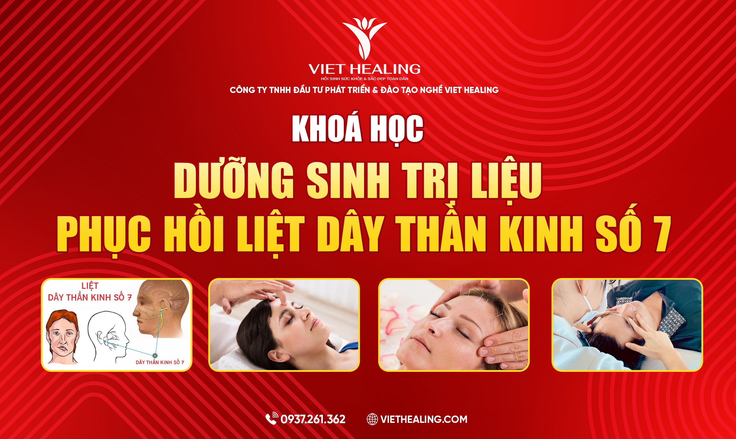 DƯỠNG SINH TRỊ LIỆU PHỤC HỒI LIỆT DÂY THẦN KINH SỐ 7