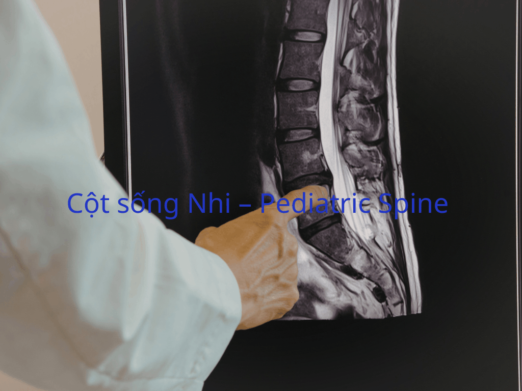 Cột sống Nhi – Pediatric Spine
