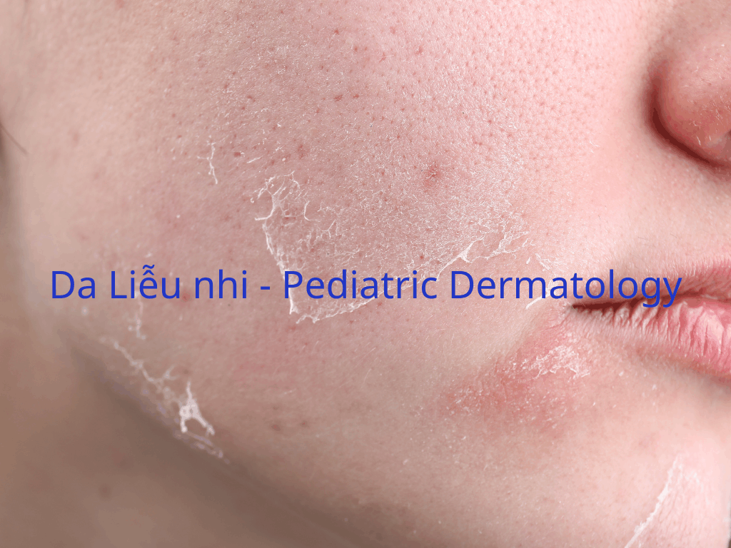 Da Liễu nhi - Pediatric Dermatology