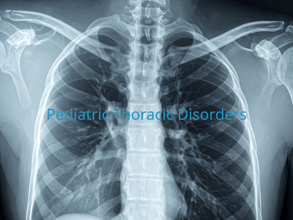 Pediatric Thoracic Disorders