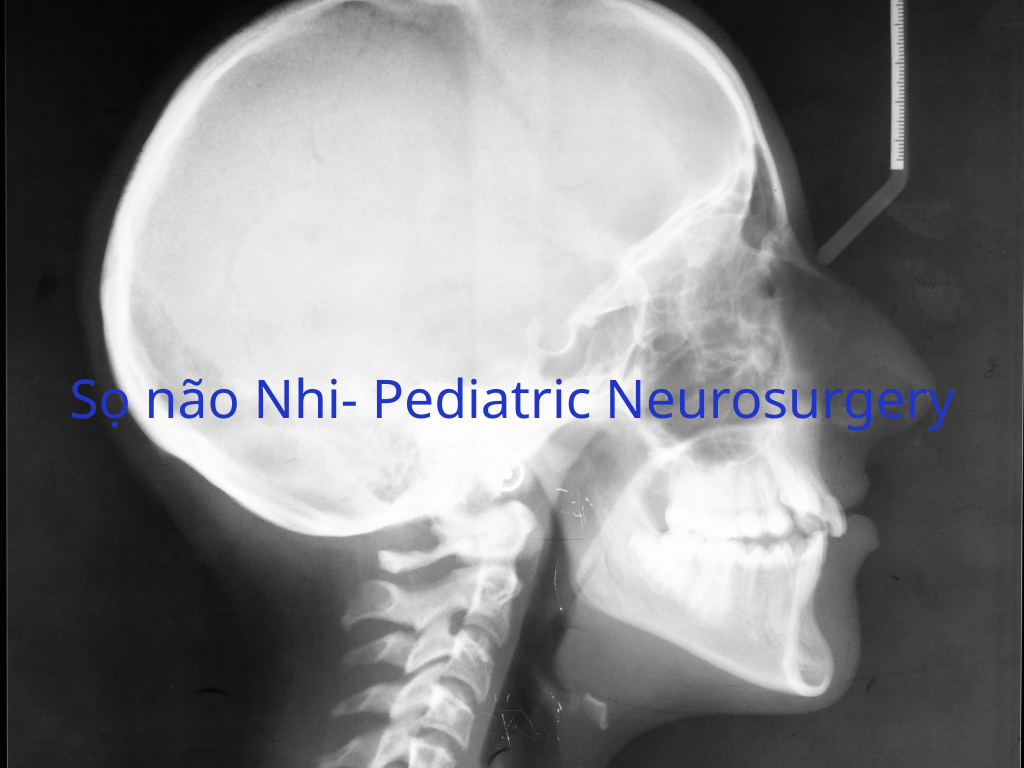 Sọ não Nhi- Pediatric Neurosurgery