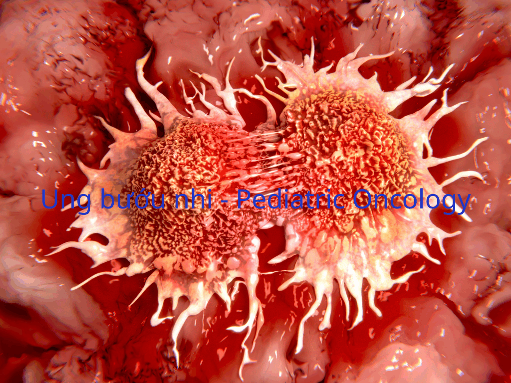 Ung bướu nhi - Pediatric Oncology